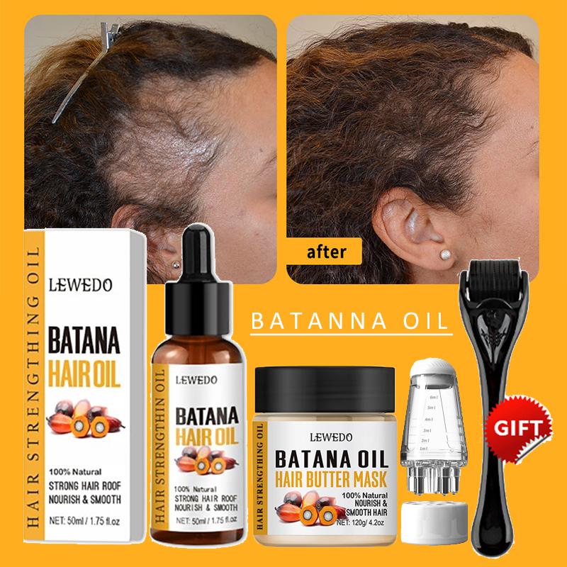 Ingrown Hair Serum - Batana Oil Hair Growth Kit Traction