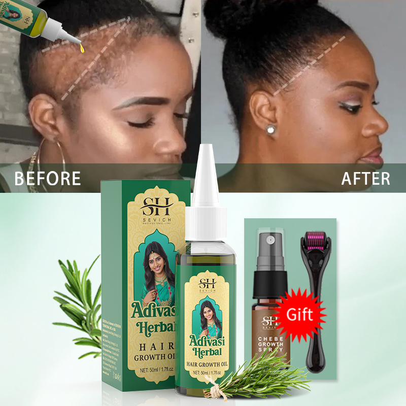 Ayurvedic Hair Growth Oil Indi - Ingrown Hair Serum recensie en prijs