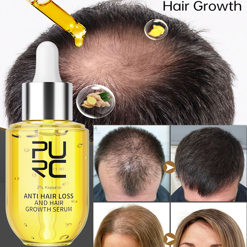 PURC Hair Growth Serum for Men - Ingrown Hair Serum recensie en prijs