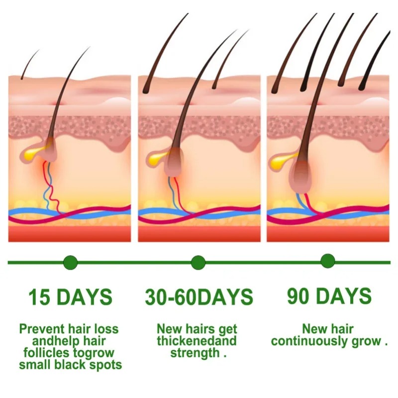 Hair Growth Serum Fast Growing - Ingrown Hair Serum recensie en prijs