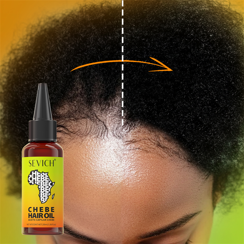 Chebe Fast Hair Growth Oil Afr - Ingrown Hair Serum recensie en prijs