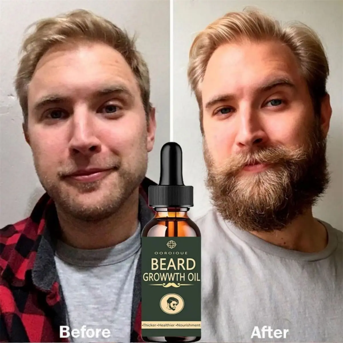 Fast Beard Growth Oil Beard Oi - Ingrown Hair Serum recensie en prijs