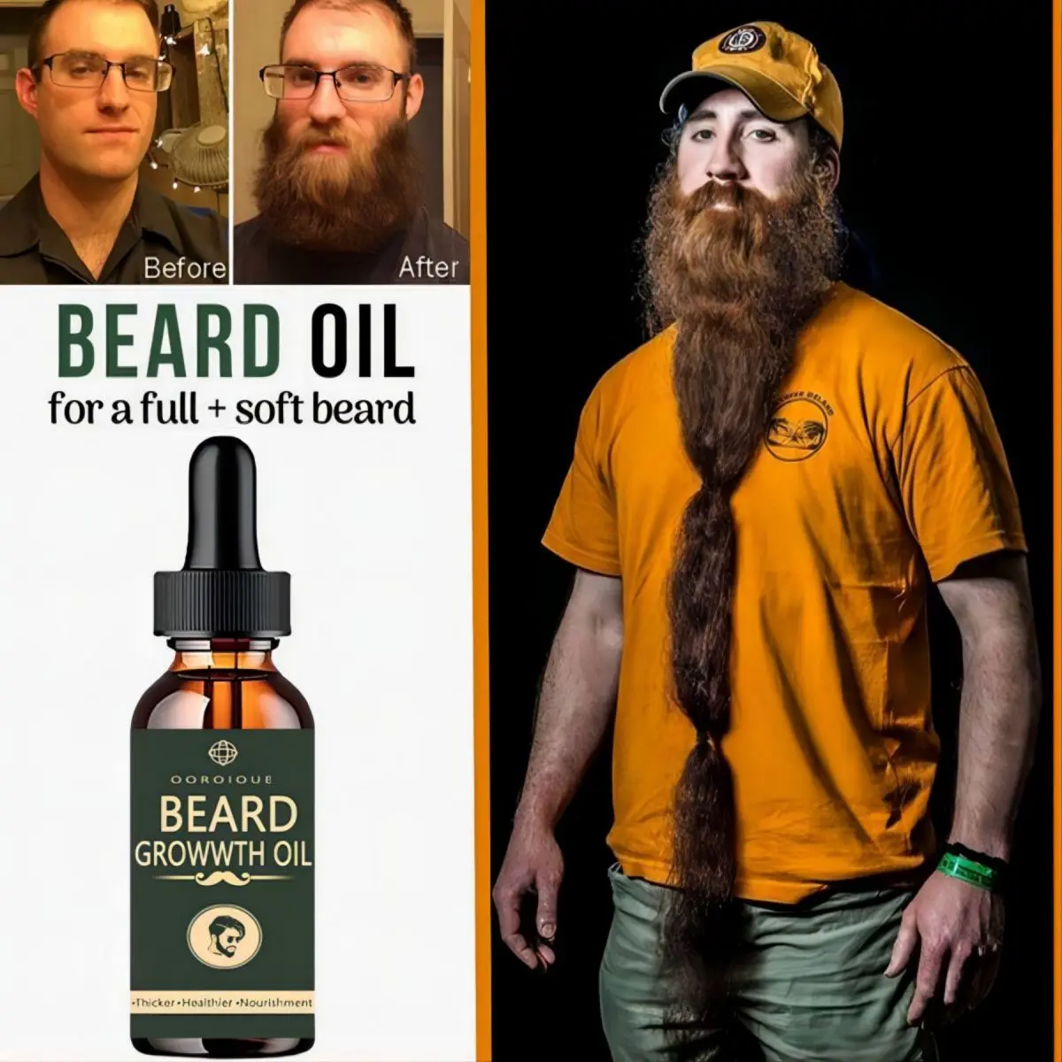 Fast Beard Growth Oil Beard Oi - Ingrown Hair Serum recensie en prijs