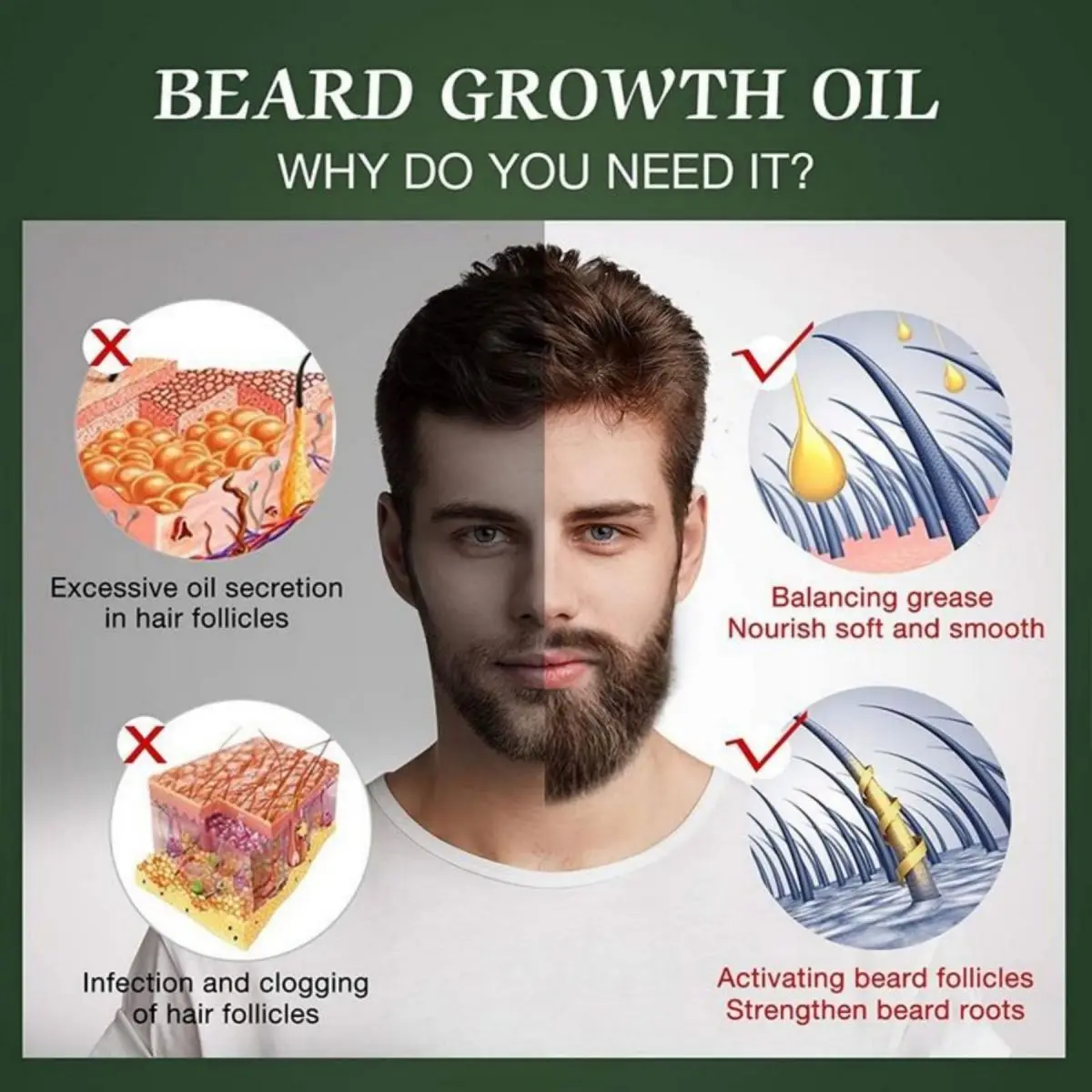 Fast Beard Growth Oil Beard Oi - Ingrown Hair Serum recensie en prijs