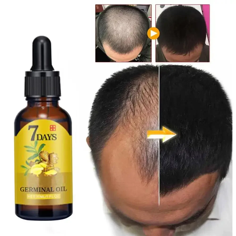 Hair Growth Ginger Fast Growin - Ingrown Hair Serum recensie en prijs