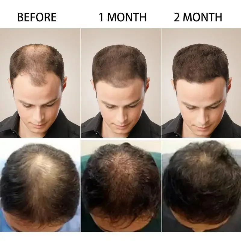 Hair Growth Ginger Fast Growin - Ingrown Hair Serum recensie en prijs