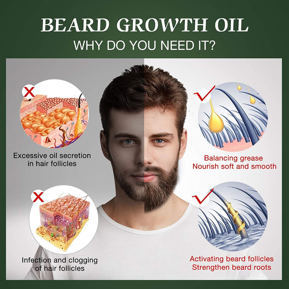 Fast Beard Growth Oil Beard Oi - Ingrown Hair Serum recensie en prijs