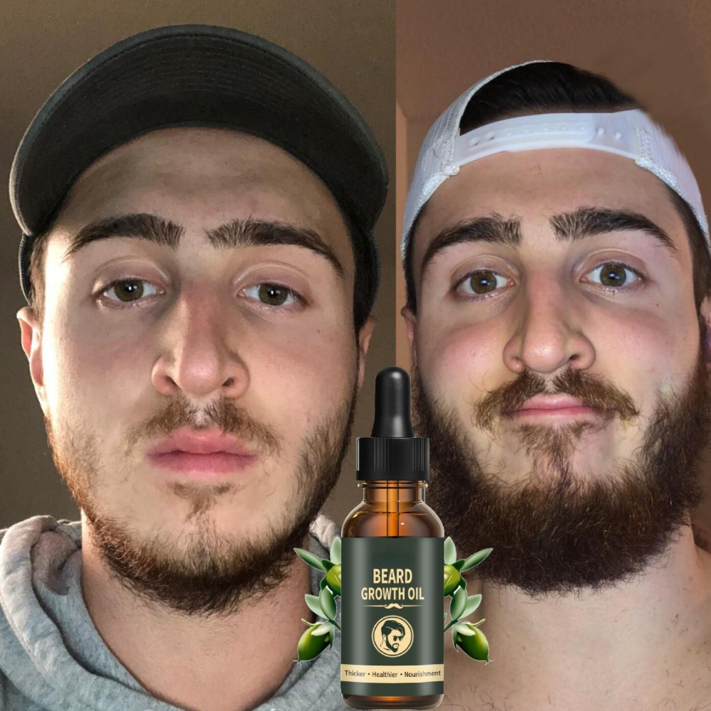 Fast Beard Growth Oil Beard Oi - Ingrown Hair Serum recensie en prijs